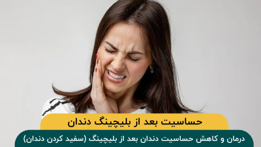 حساسیت-دندان-بعد-از-بلیچینگ